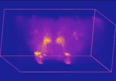 Brain imaging of a fruit fly Brain imaging of a fruit fly